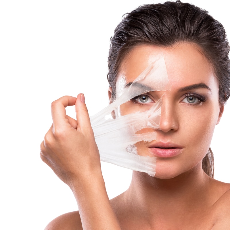 Cosmelan Peel Treatment