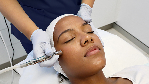 Microdermabrasion Treatment