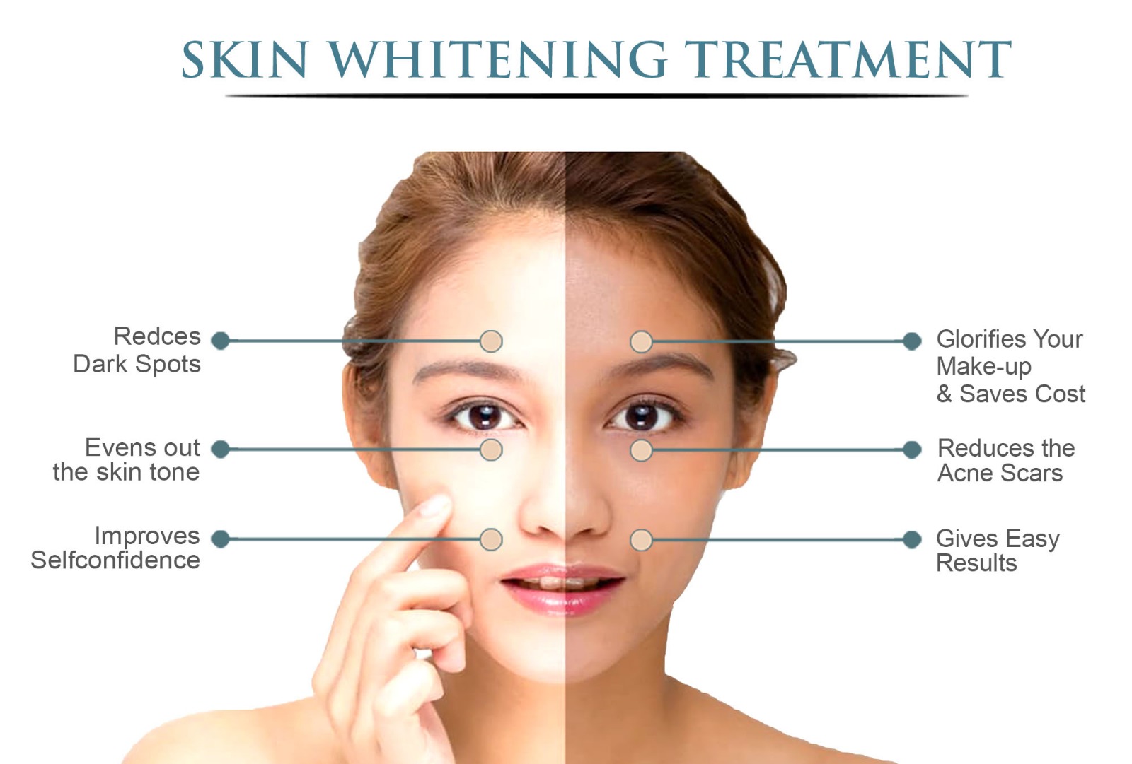 Skin Brightening Treatment Treatment Effective Solutions for Skin Care