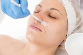 Phenol Peel Treatment