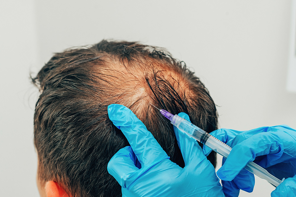 Expert Dermatologist for Hair Loss Treatment – Trusted Care at Cosderma, Dermatologist for Hair Loss Treatment, Hair Loss Specialist Doctor, Expert Hair Fall Treatment, Trusted Dermatologist for Hair Regrowth, Hair Loss Treatment by Cosderma, Hair Fall Dermatologist Near Me