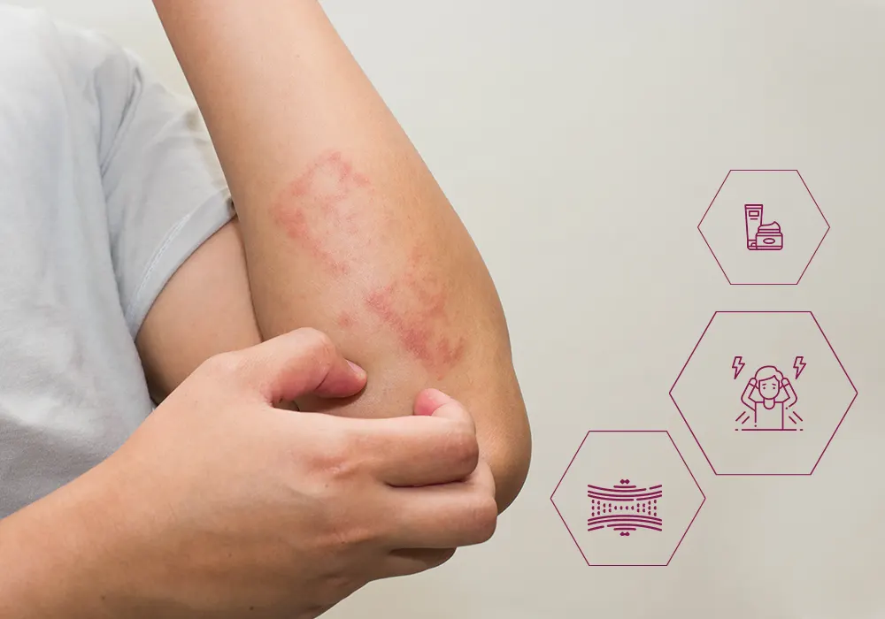 Cosderma: Leading Clinic for Skin Allergy Treatment