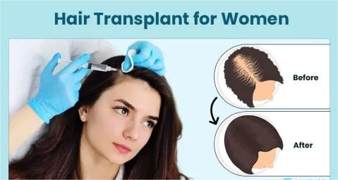 Hair Transplant