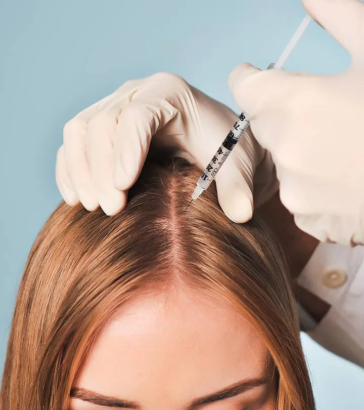 Meso Hair Treatment for Female Pattern Hair Loss, Mesotherapy for Female Hair Loss, Meso Hair Regrowth Treatment for Women, Mesotherapy for Thinning Hair in Women, Female Hair Loss Mesotherapy, Hair Loss Treatment with Mesotherapy