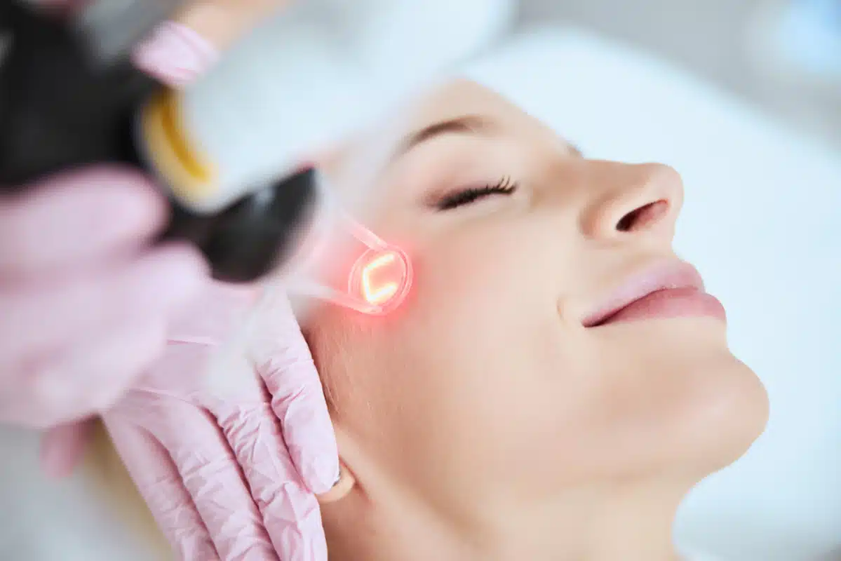 CO₂ Laser Therapy for Acne Scars, Wrinkles & Skin Texture, CO₂ fractional laser resurfacing,CO₂ laser skin treatment, Advanced skin resurfacing procedure, Laser resurfacing for acne scars, Wrinkle and scar removal laser, Fractional CO₂ laser for face, Laser skin rejuvenation near me, Best CO₂ laser treatment clinic, Anti-aging laser treatment, Skin texture improvement with CO₂ laser