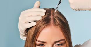 Stem Cells Treatment for Female Pattern Hair Loss