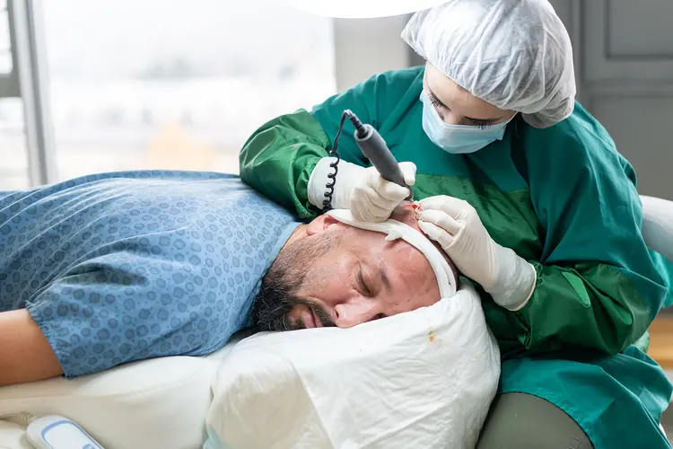 hair transplant