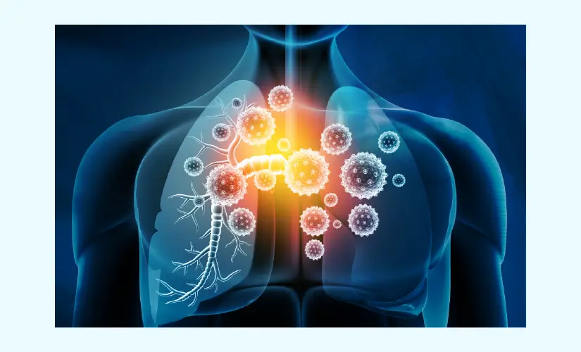 Viral infection treatment, Treatment for viral infections, Viral illness management, Antiviral therapy, Viral infection doctor near me, Best clinic for viral infections